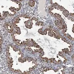 Merck Anti-FAM78A antibody produced in rabbit