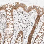 Merck Anti-PPM1K antibody produced in rabbit