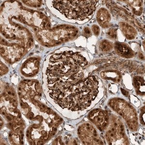 Merck Anti-GIGYF1 antibody produced in rabbit