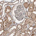 Merck Anti-GBA2 antibody produced in rabbit