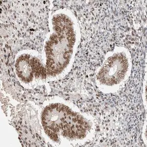 Merck Anti-PUS7 antibody produced in rabbit