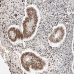 Merck Anti-PUS7 antibody produced in rabbit