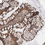 Merck Anti-KIF12 antibody produced in rabbit