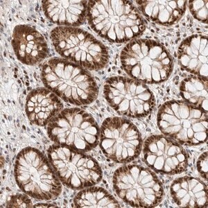 Merck Anti-TSPAN32 antibody produced in rabbit