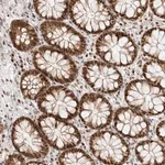 Merck Anti-TSPAN32 antibody produced in rabbit