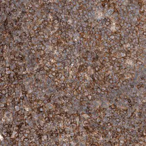 Merck Anti-UGCG antibody produced in rabbit