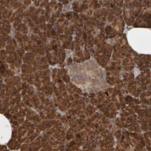 Merck Anti-AGBL3 antibody produced in rabbit