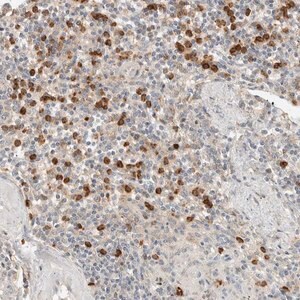 Merck Anti-CCDC171 antibody produced in rabbit