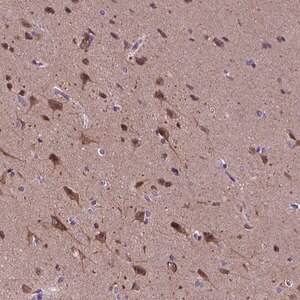 Merck Anti-KIAA1107 antibody produced in rabbit