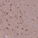 Merck Anti-KIAA1107 antibody produced in rabbit