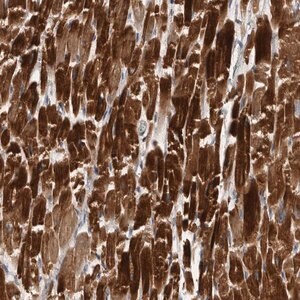 Merck Anti-ZNF114 antibody produced in rabbit