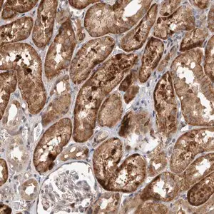 Merck Anti-INSRR antibody produced in rabbit