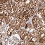 Merck Anti-INSRR antibody produced in rabbit