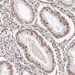 Merck Anti-ZNF282 antibody produced in rabbit