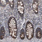 Merck Anti-TECPR1 antibody produced in rabbit