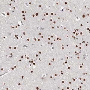 Merck Anti-ZBTB49 antibody produced in rabbit