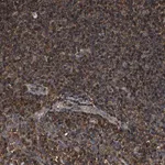 Merck Anti-KBTBD2 antibody produced in rabbit