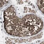 Merck Anti-TRPC1 antibody produced in rabbit