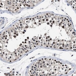 Merck Anti-USP16 antibody produced in rabbit