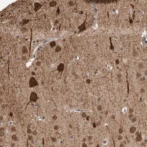 Merck Anti-OR2K2 antibody produced in rabbit