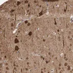 Merck Anti-OR2K2 antibody produced in rabbit