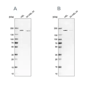 Merck Anti-SMARCC2 antibody produced in rabbit