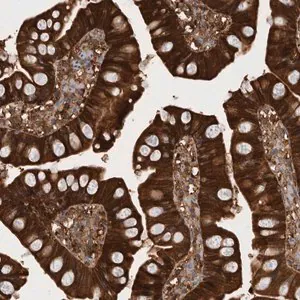 Merck Anti-RHPN1 antibody produced in rabbit