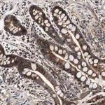 Merck Anti-SCYL2 antibody produced in rabbit