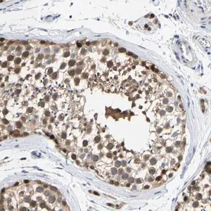 Merck Anti-KLHL1 antibody produced in rabbit