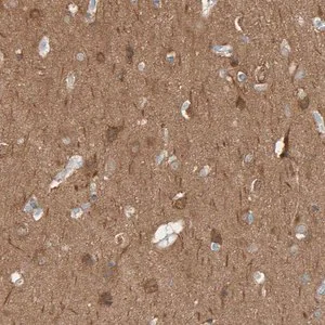 Merck Anti-IPPK antibody produced in rabbit