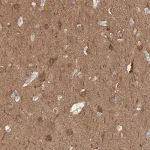 Merck Anti-IPPK antibody produced in rabbit