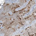 Merck Anti-CHPF2 antibody produced in rabbit