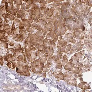 Merck Anti-CCDC144A antibody produced in rabbit