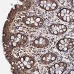 Merck Anti-DSCR3 antibody produced in rabbit