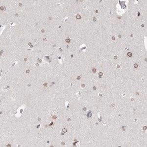 Merck Anti-ZNF770 antibody produced in rabbit