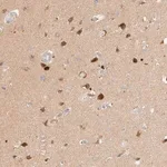 Merck Anti-SGSM2 antibody produced in rabbit