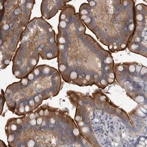 Merck Anti-ENPP7 antibody produced in rabbit