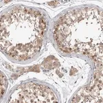 Merck Anti-ZNF341 antibody produced in rabbit