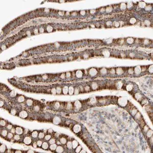 Merck Anti-CHADL antibody produced in rabbit
