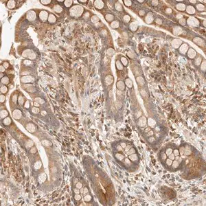 Merck Anti-TACC1 antibody produced in rabbit