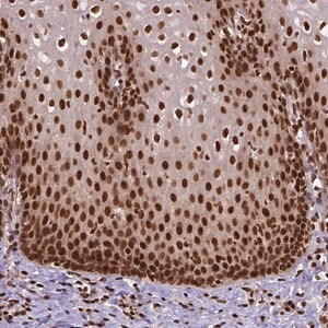 Merck Anti-NACC1 antibody produced in rabbit