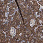 Merck Anti-ERCC6L2 antibody produced in rabbit