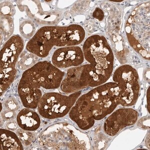 Merck Anti-CTIF antibody produced in rabbit