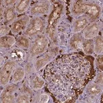 Merck Anti-BTBD17 antibody produced in rabbit