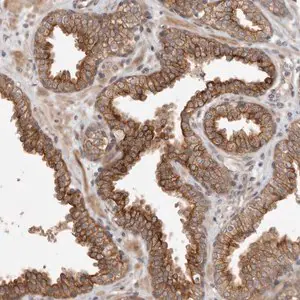 Merck Anti-CRISPLD1 antibody produced in rabbit