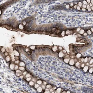 Merck Anti-ST6GALNAC6 antibody produced in rabbit