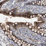 Merck Anti-ST6GALNAC6 antibody produced in rabbit