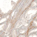 Merck Anti-FBXO42 antibody produced in rabbit