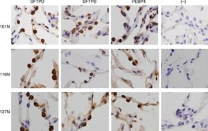 Merck Anti-PEBP4 antibody produced in rabbit