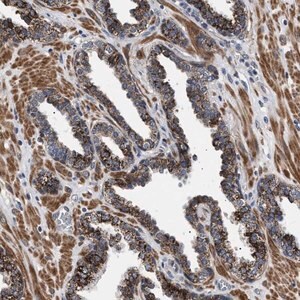 Merck Anti-RAB34 antibody produced in rabbit